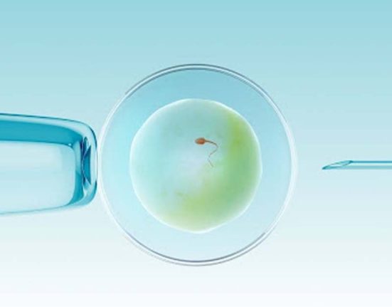 IVF Procedure